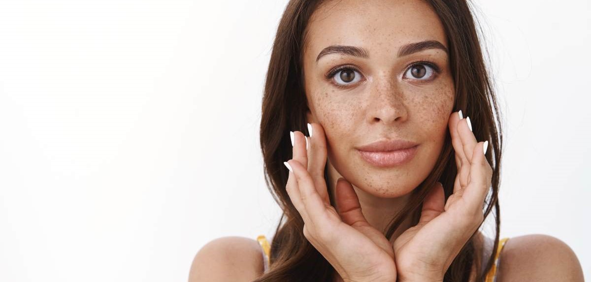 Os melhores tratamentos para melasma, rosácea e acne