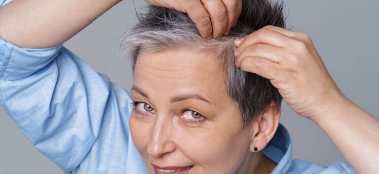 Minoxidil: Um tratamento para combater a queda de cabelo