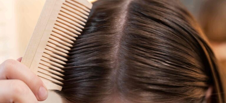 5 dicas essenciais para combater a queda de cabelo feminina