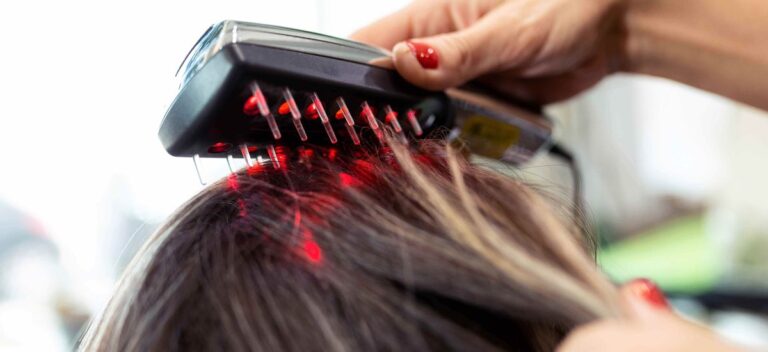 Laser capilar de baixa potência: como ele atua na saúde dos fios?