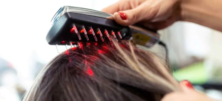 Laser capilar de baixa potência: como ele atua na saúde dos fios?